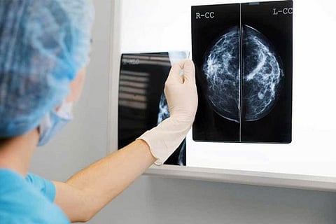 X Ray