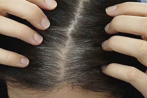 gray-hair