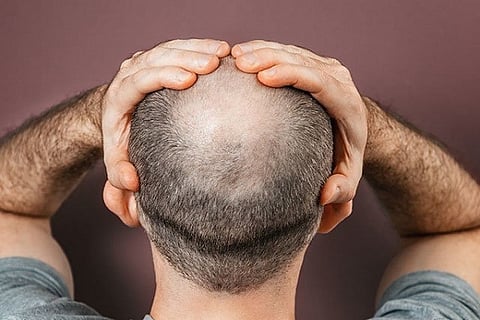 bald