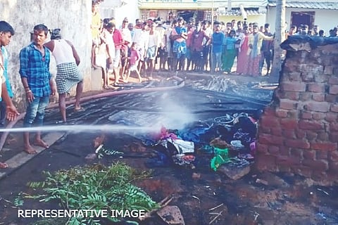 Honnali, accidental fire, accident,
