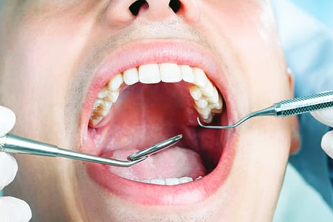 Mouth