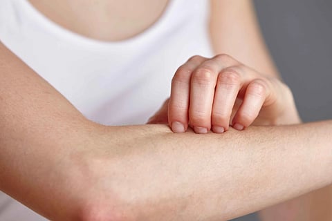 skin diseases