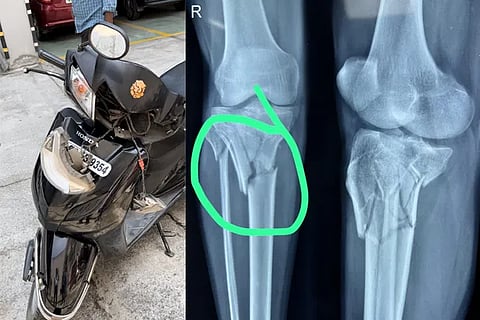 Injury
