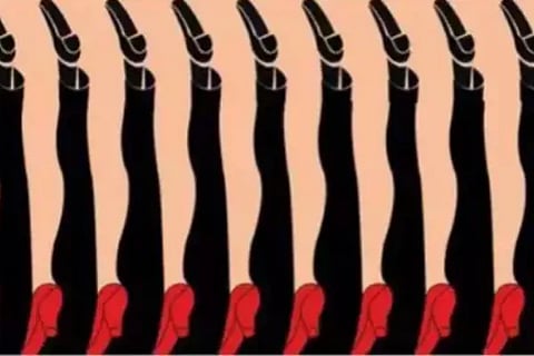 leg