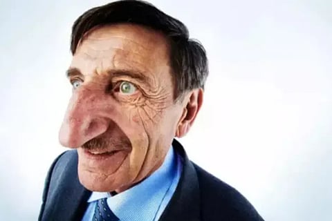 nose