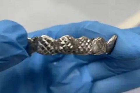 teeth