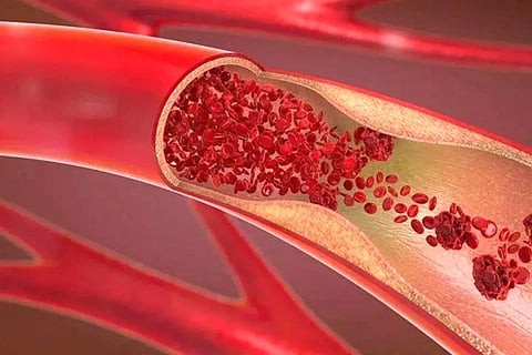 Blood Cerculation