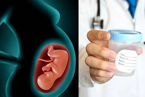Sperm
