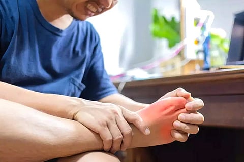 Uric Acid
