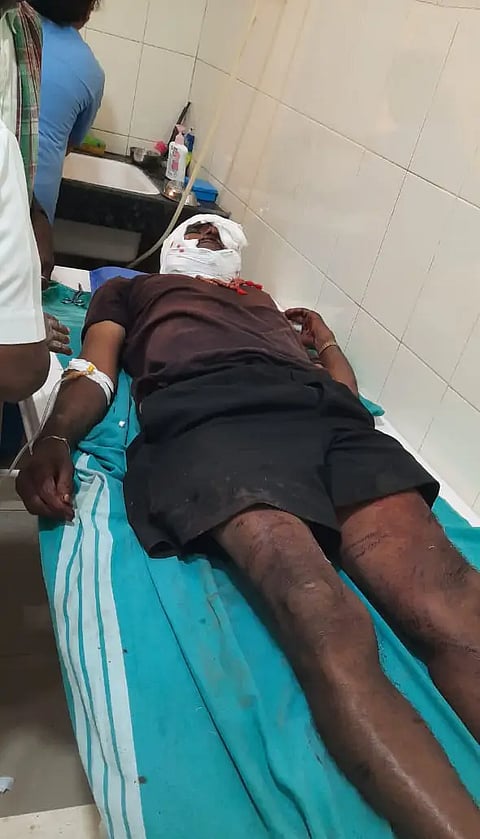 bear attack man injured