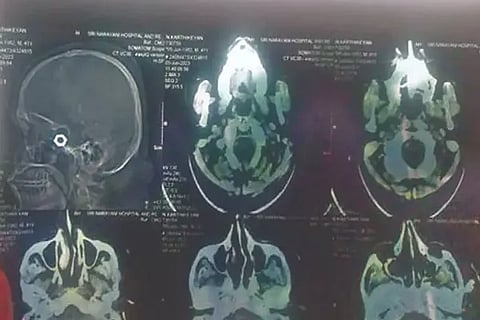 head scanning report