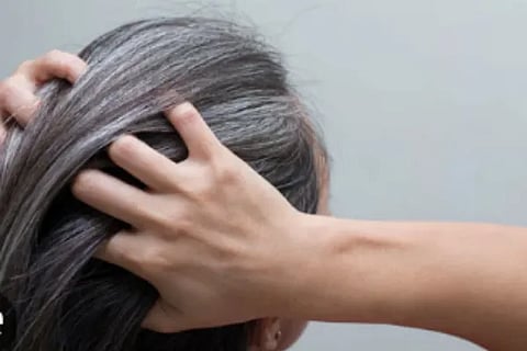 White Hair