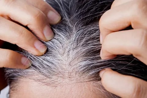 white hair