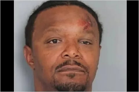 Drunk Man Bites Police Dog Multiple Times To Resist Arrest
