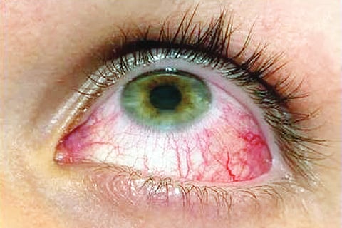GJD EYE