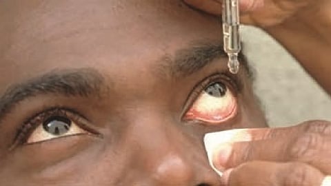 LXMR EYE