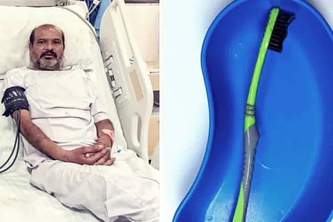 Udaipur Man gulps 12-cm-long toothbrush taken out from stomach without surgery