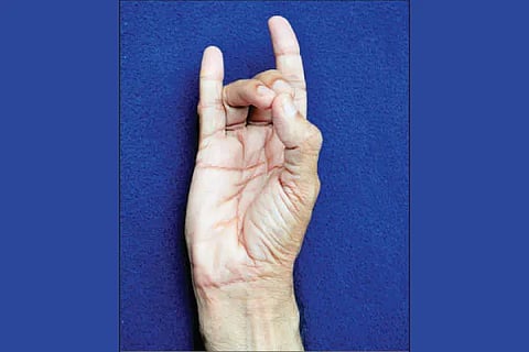 apana mudra