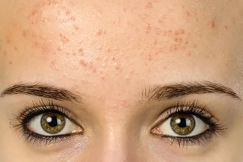 skin