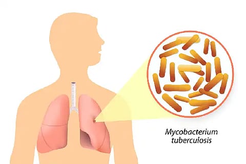 Tuberculosis, society, cooperation,