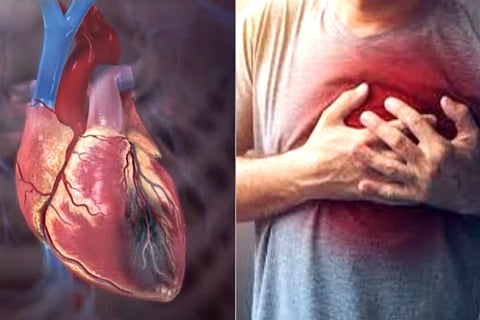 Heart Health