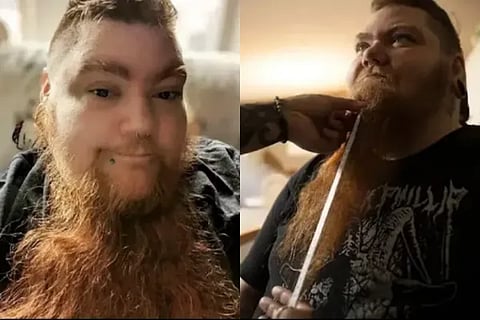 US woman grabs Guinness World Record for longest beard on a female