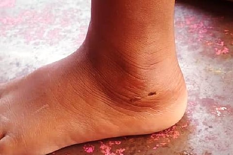 stray dog attacked on playing child