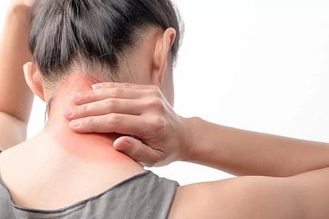 fibromyalgia syndrome