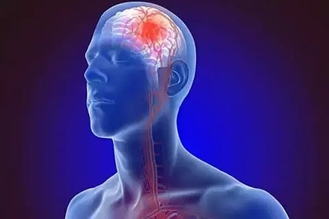 brain (1)