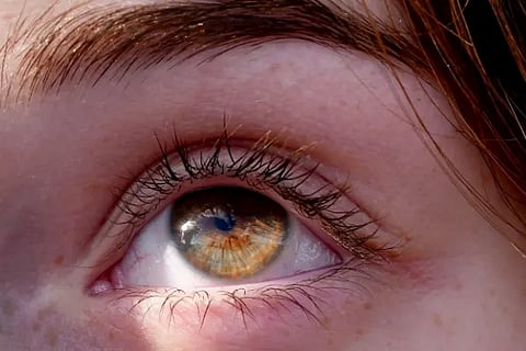 eye