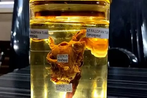 uterus