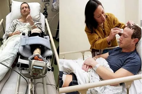 Mark Zuckerberg Undergoes Surgery After Knee Injury Shares Pics On Instagram