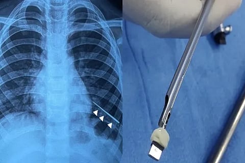 AIIMS Surgery