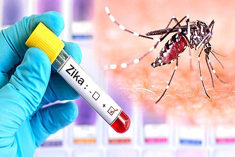 Zika Virus