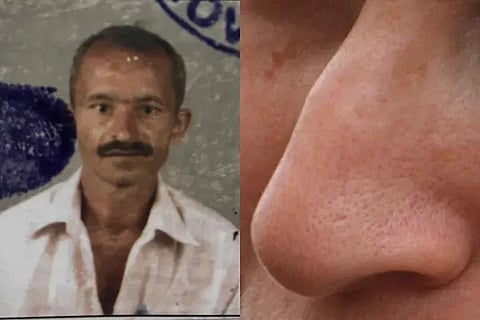 Belgaum Nose