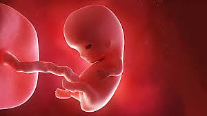 Fetal