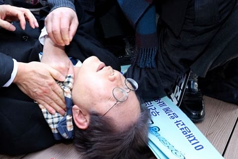 South Korea politician stabbed in the neck in public massive bleeding feared