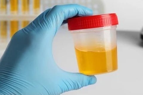 urine