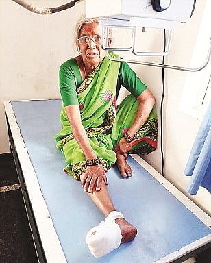 HUN-MAR-18-1(INJURED NAGAMMA)