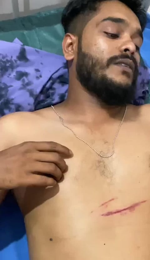 Oplus_0