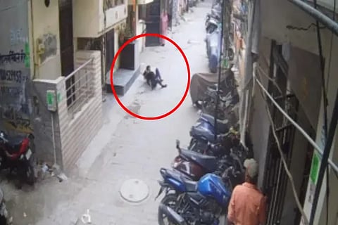 Pitbull attack