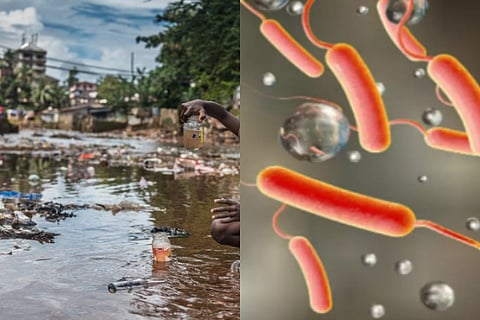 cholera