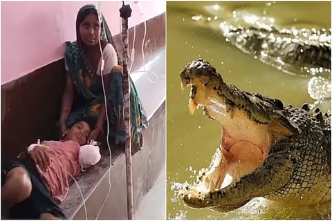Crocodile Attack