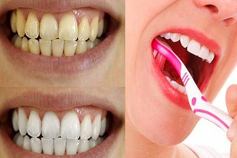 Teeth Health