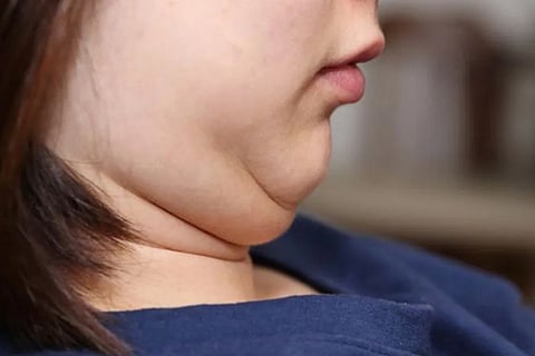 chin