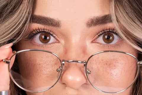 eye