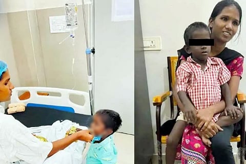 Osmania Hospital doctors transplant part of liver donated by mother on 3yr old boy