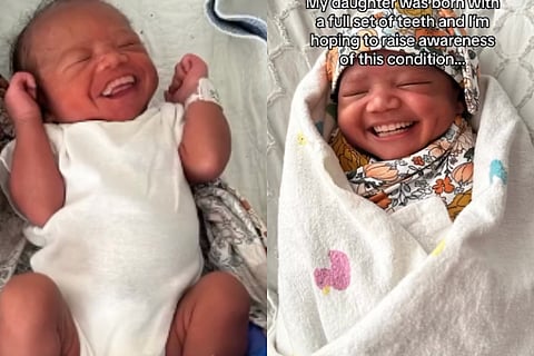 baby viral