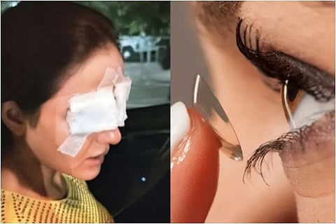 contactlenses