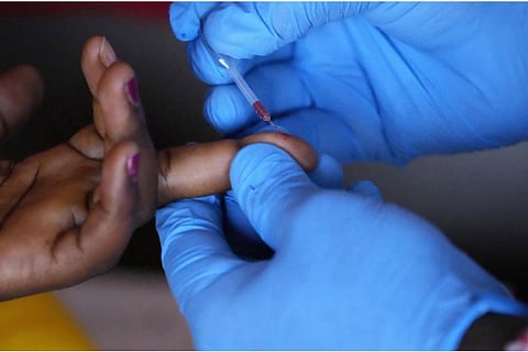 hiv